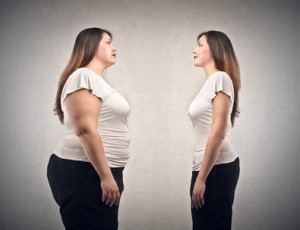 Método POSE, reducción de estómago sin cirugia tratar el sobrepeso