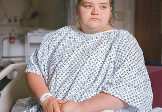 Superobesidad y obesidad mórbida en adolescentes