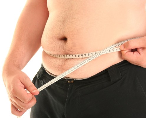 engordar después de una cirugía de la obesidad