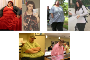 historias de obesidad mórbida
